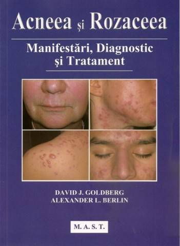Acneea si rozaceea de David J. Goldberg [1]