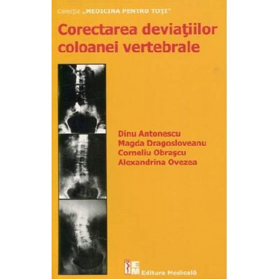 Corectarea deviatiilor coloanei vertebrale. Editia a II-a de Dinu Antonescu [1]