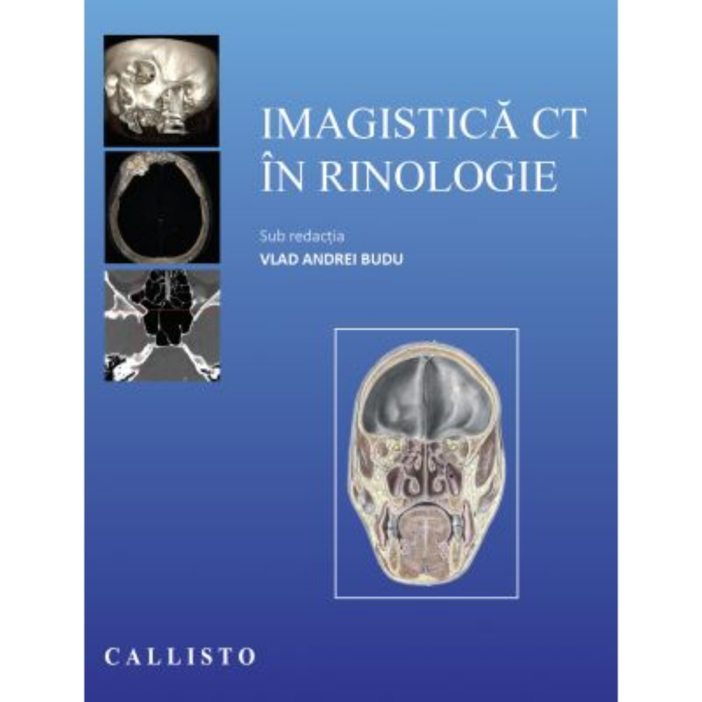Imagistica CT in rinologie de Vlad Andrei Budu [1]