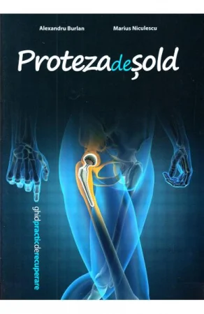 Proteza de sold [1]