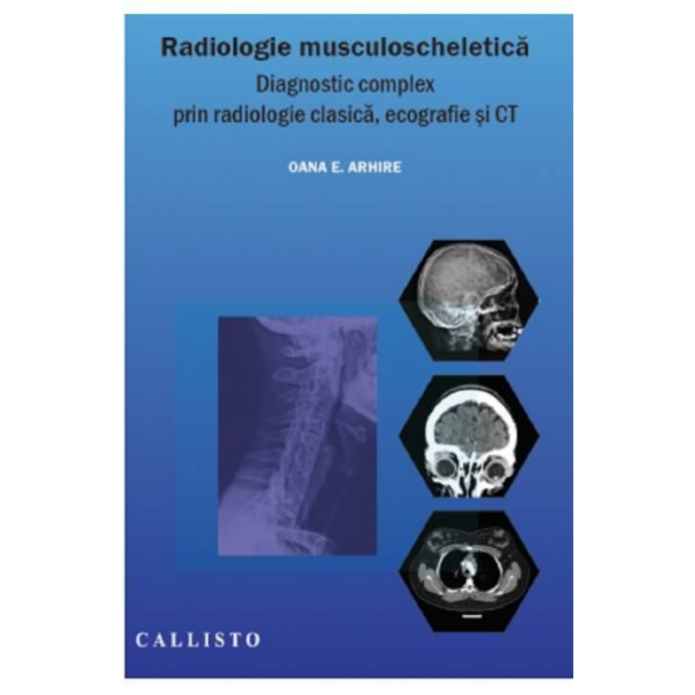 Radiologie musculoscheletica de Oana E. Arhire [1]