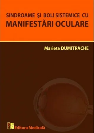 Sindroame si boli sistemice cu manifestari oculare de Marieta Dumitrache [1]