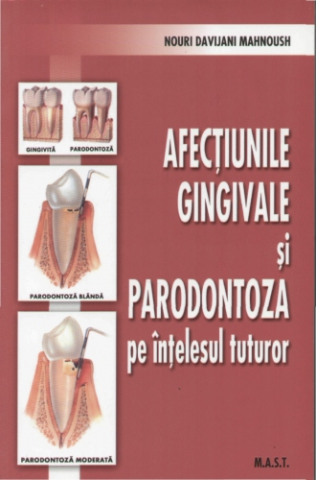 Medicina & Farmacie - Afectiunile gingivale si paradontoza pe intelesul tuturor de Nouri Davijani Mahnoush