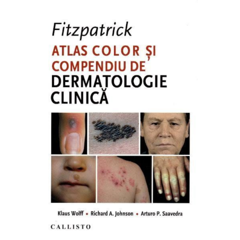 Sanatate - Fitzpatrick. Atlas color si compendiu de dermatologie clinica de Klaus Wolff
