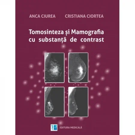 Sanatate - Tomosinteza si mamografia cu substanta de contrast de Anca Ciurea, Cristiana Ciortea