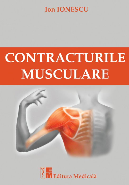Contracturile musculare de Ion Ionescu [1]