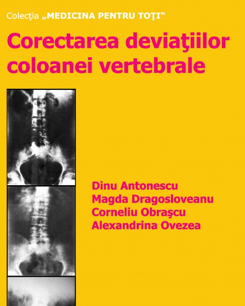 Corectarea deviatiilor coloanei vertebrale. Editia a II-a [1]