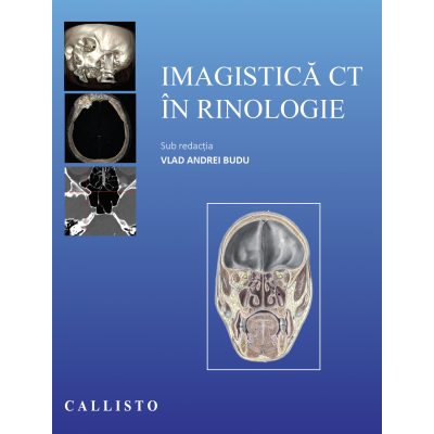 Imagistica CT in rinologie de Vlad Andrei Budu [1]