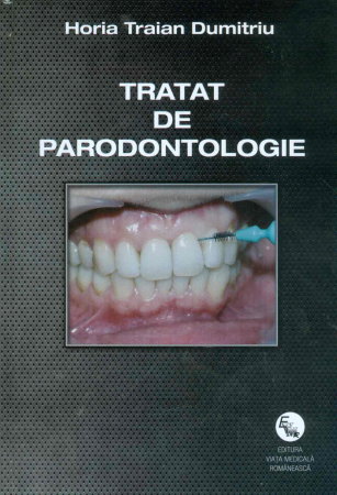 Medicina & Farmacie - Tratat de parodontologie de Horia Traian Dumitru