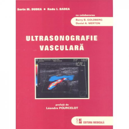 Sanatate - Ultrasonografie Vasculara de Sorin M. Dudea, Radu I. Badea