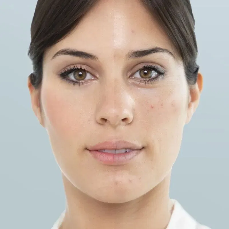 Aparat sauna faciala, hidratare si curatare Hidraspa [4]