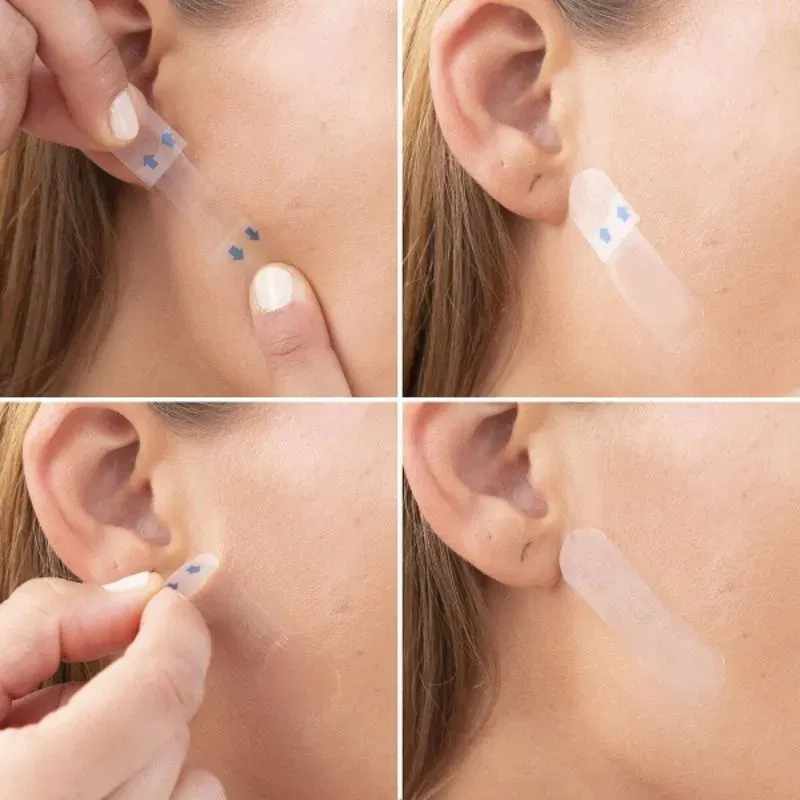 Set 40 Plasturi Invizibili pentru Lifting Facial [3]