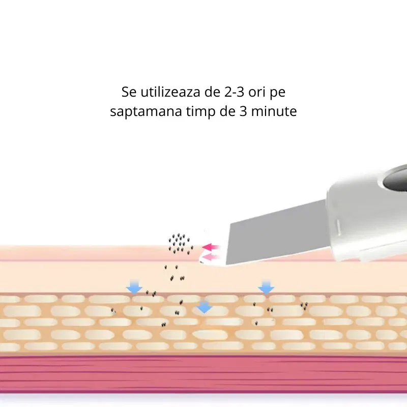 Aparat de peeling ultrasonic pentru fata [6]