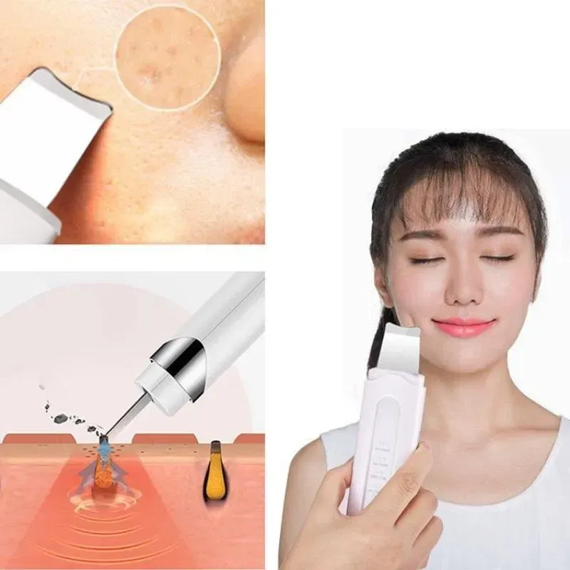 Aparat de peeling ultrasonic pentru fata [5]