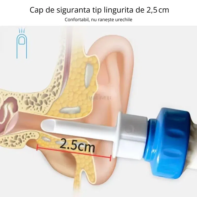 Dispozitiv electric curatarea urechilor [9]