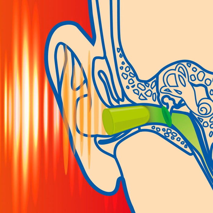 Dopuri de urechi pentru copii, pentru protectia auzului impotriva zgomotului, 3 ani+, SNR 33dB, 12 bucati, spuma, portocaliu, SANOHRA Max Kids [6]