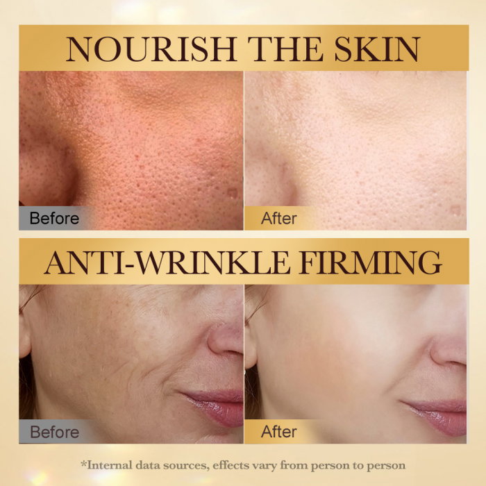 Ser Antirid si Hidratant cu Venin de Albine, Bee Venom Anti-Wrinkle, Sadoer, 50g [5]