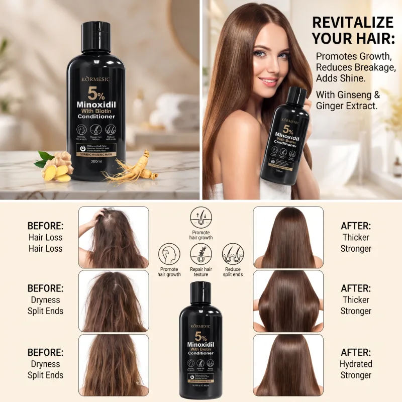 Balsam cu 5% Minoxidil și Biotină, pentru Creșterea Părului și Hidratare Intensă, Kormesic ,300ml [3]