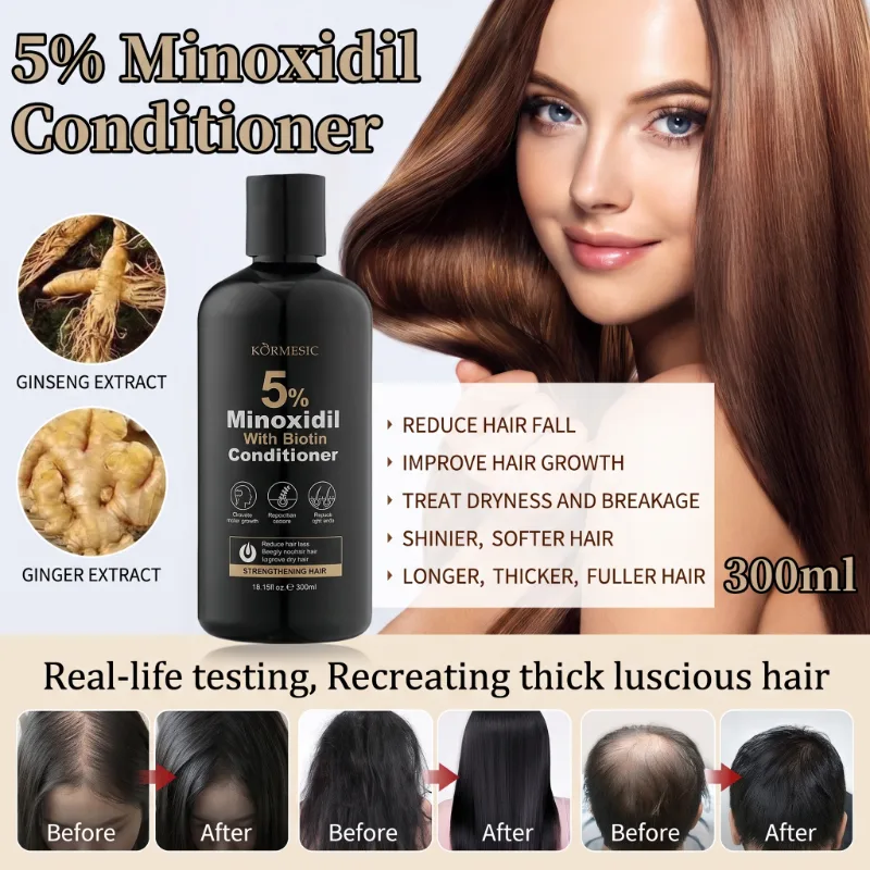 Balsam cu 5% Minoxidil și Biotină, pentru Creșterea Părului și Hidratare Intensă, Kormesic ,300ml [9]