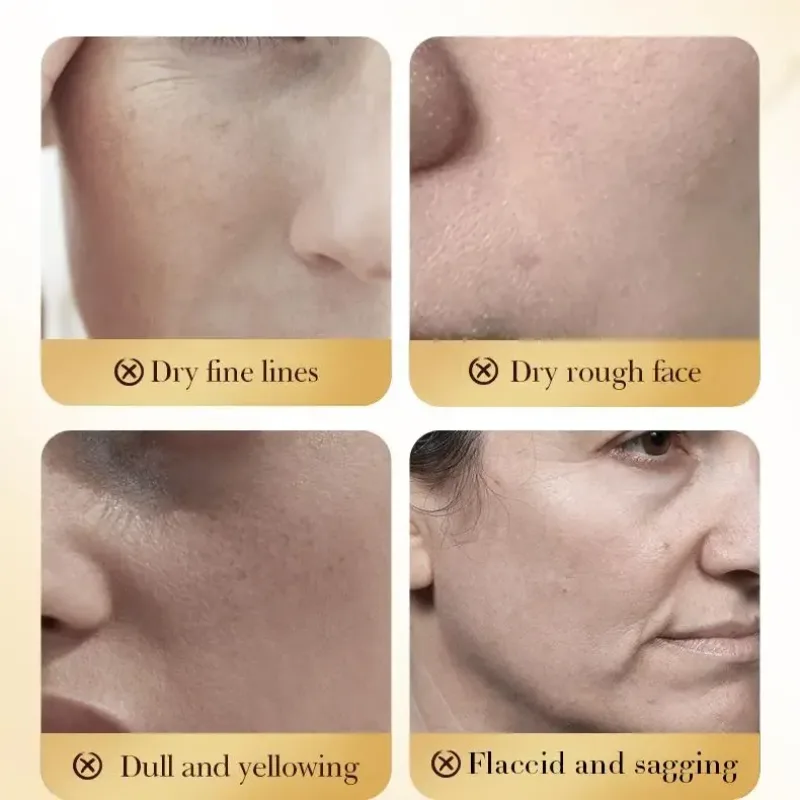 sadoer-bee-venom-anti-wrinkle-cream-50g [10]