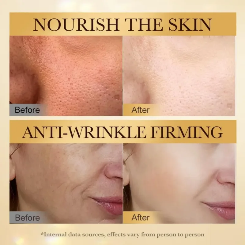 sadoer-bee-venom-anti-wrinkle-cream-50g [2]