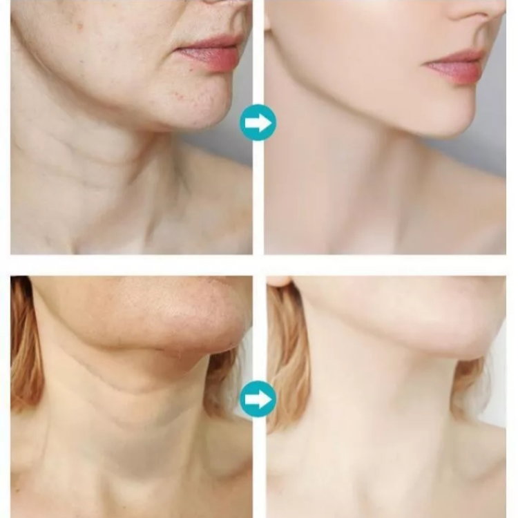 Cremă Dr. Rashel pentru lifting gât și decolteu cu acid hialuronic 5D și aplicator masaj [5]