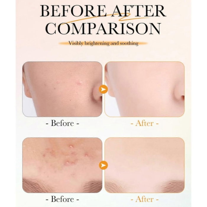 Dischete Sadoer Vitamin C Salicylic Acid Whiten Soothe Cotton Pads 55 bucati cu Vitamina C 98%, Acid Salicilic si Niacinamida – anti-acnee, pori dilatati, pete pigmentare, iluminare ten [5]