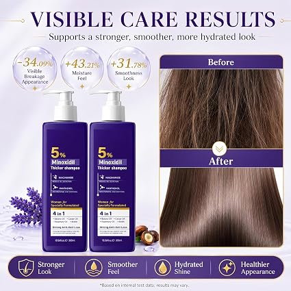 Șampon 4in1 cu Minoxidil 5% și Biotină, pentru Creșterea Părului și Hidratare Intensă, Kormesic, 300ml [6]