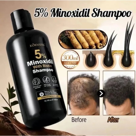 Șampon cu 5% Minoxidil și Biotină, pentru Creșterea Părului și Curățare Intensă, Kormesic, 300ml [5]
