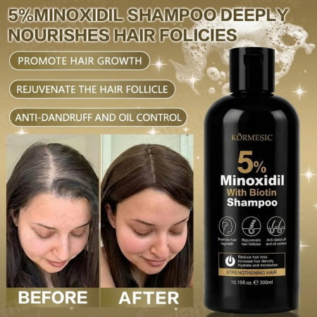 Șampon cu 5% Minoxidil și Biotină, pentru Creșterea Părului și Curățare Intensă, Kormesic, 300ml [6]