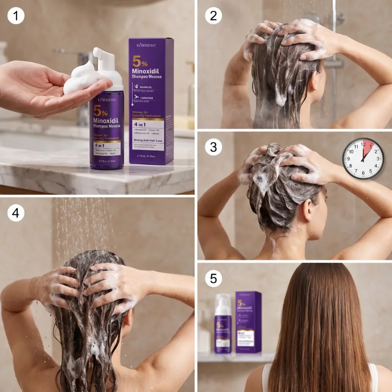 Sampon Spuma 4in1 cu 5% Minoxidil si Biotina, pentru Cresterea Parului si Hidratare Intensa, Kormesic ,60ml [4]