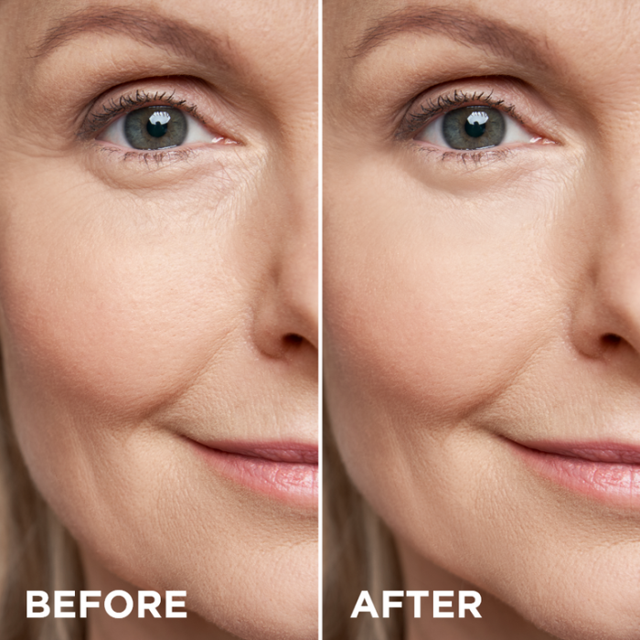 Ser Antirid Eveline Gold Vitamin C 24K Super Lifting cu Particule Aur și Manuka - 30ml [3]