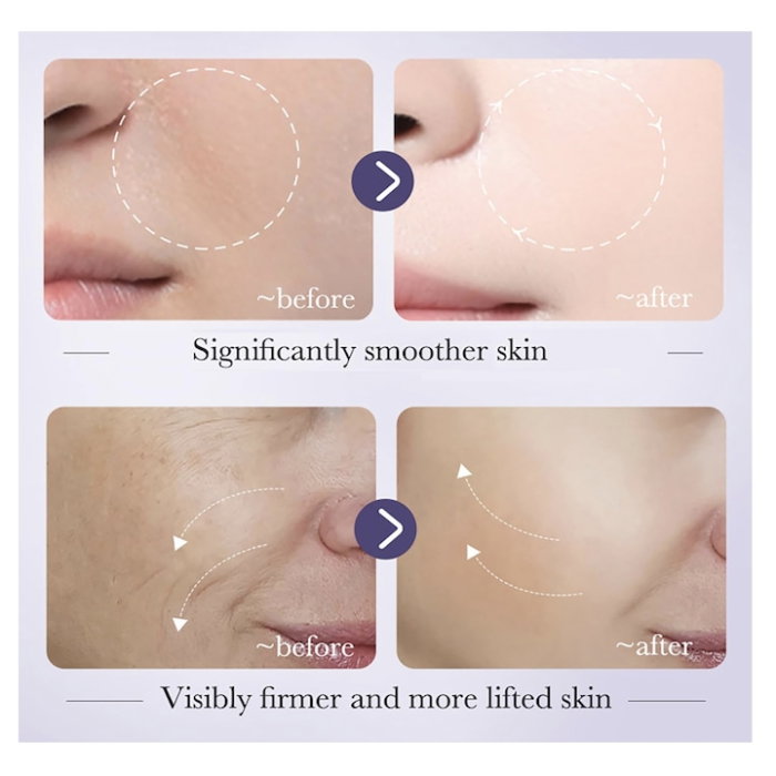 Ser Antirid cu Retinol 8.5% și Acid Hialuronic 5%, Fermitate & Uniformizare Ten, BIOAQUA, 30ml [3]