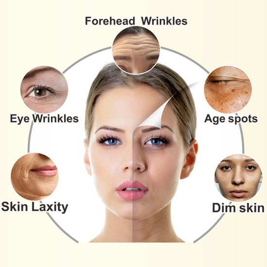 Ser cu Aur 24K și Acid Hialuronic, Antirid și Hidratant, Skin Clinic, Kiss Beauty, 30ml [3]
