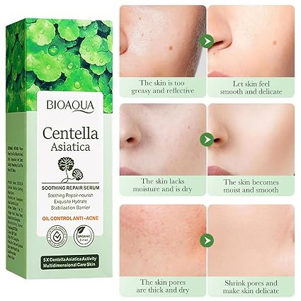 Ser pentru față cu Centella Asiatica, Anti-Acnee, Reparare și Hidratare, BIOAQUA, 50g [4]