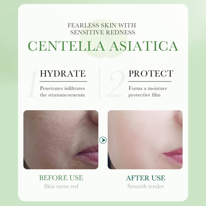 Ser pentru față cu Centella Asiatica, Anti-Acnee, Reparare și Hidratare, BIOAQUA, 50g [6]
