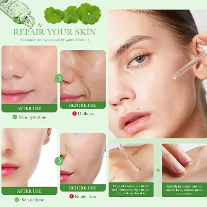 Ser pentru față cu Centella Asiatica, Anti-Acnee, Reparare și Hidratare, BIOAQUA, 50g [5]