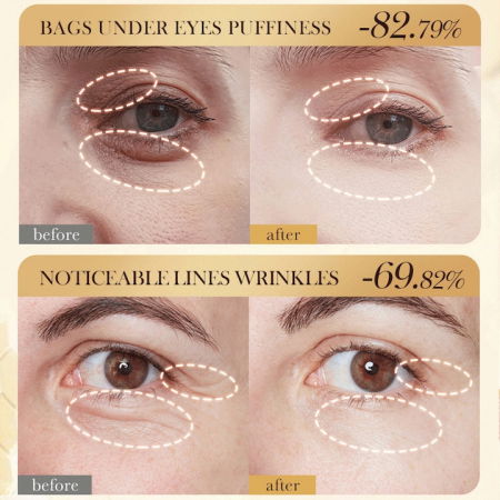 Crema antirid pentru Ochi cu Venin de Albine, Efect de Lifting, 20g [6]