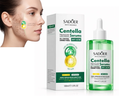 Toate Produsele Ingrijirea Tenului - Ser Anti-Acnee cu Centella, pentru Pete Pigmentare si Antirid, Sadoer, 100ml