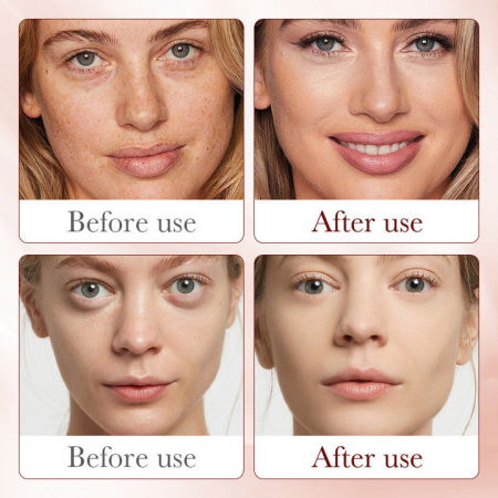 Ser Antirid cu Dragon Blood, Iluminare si Hidratare, Sadoer, 30ml [3]