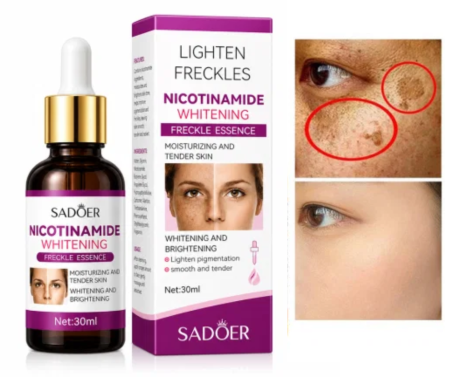 SKINCARE - Ser Facial cu Nicotinamide pentru Pete Pigmentare si Post-Acneice, Sadoer, 30ml