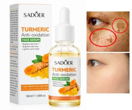 Seruri și Uleiuri Faciale - Ser Facial cu Turmeric pentru Pete Pigmentare si Post-Acneice Sadoer 30ml