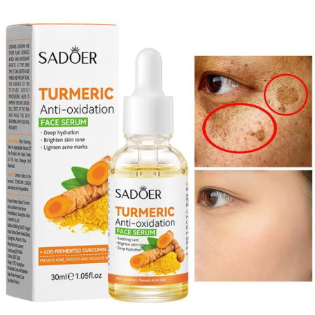 SKINCARE - Ser Facial cu Turmeric pentru Pete Pigmentare si Post-Acneice, Sadoer, 30ml