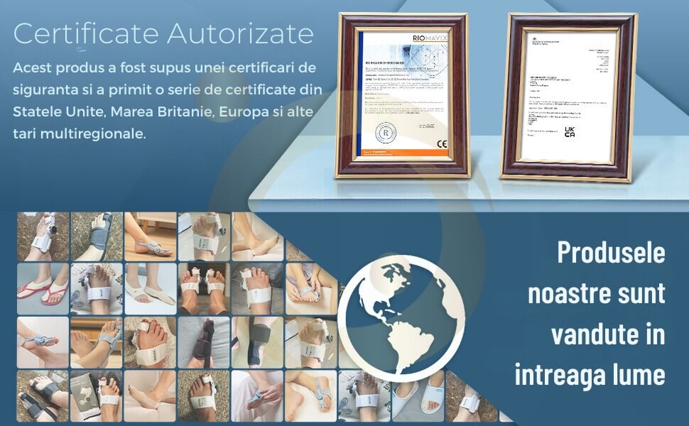 hallux valgus tratament naturist