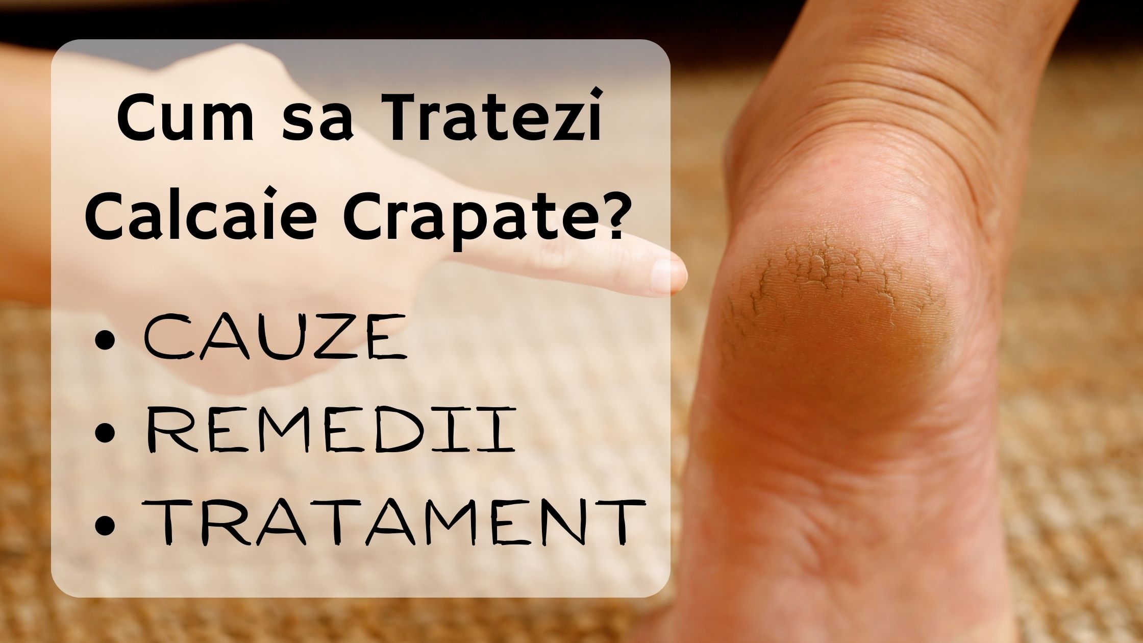 Cum sa-ti tratezi Calcaiele Crapate - Cauze, remedii si tratament