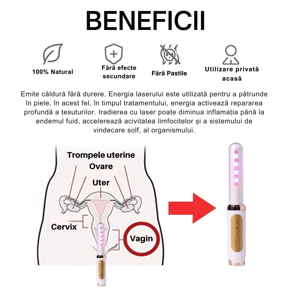 Bagheta Ginecologica cu Laser si Vibratii pentru Sanatatea Vaginala [20]