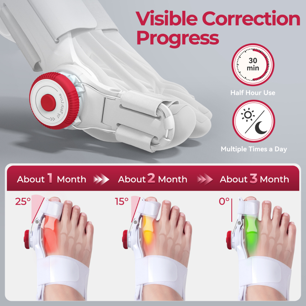 Corector monturi copii reglabil 3D pentru Hallux Valgus [5]