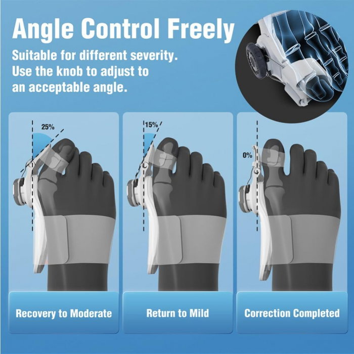 Corector Monturi Hallux Valgus Ajustabil – Deget [8]