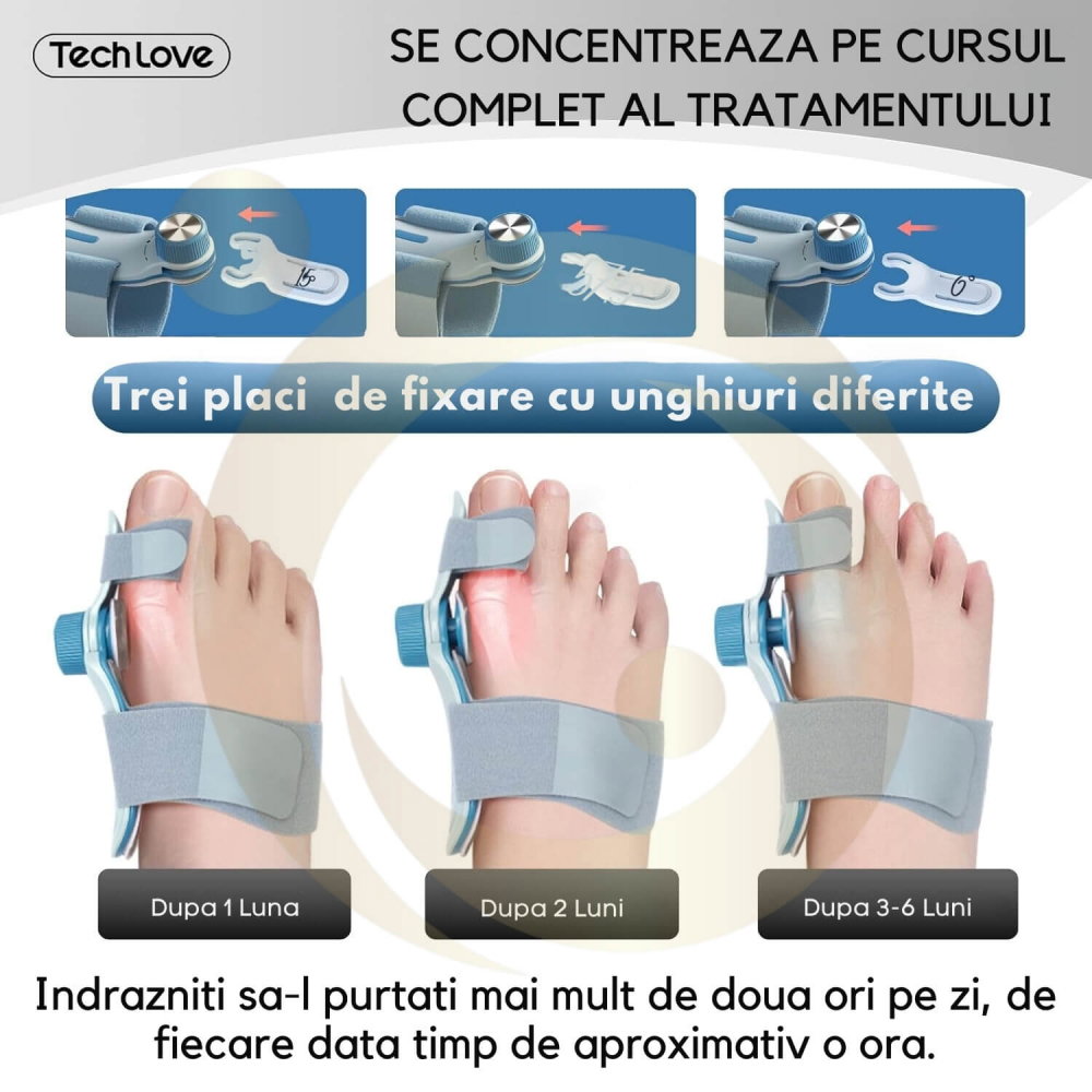Corector de monturi Tech Love pentru femei si barbati [4]