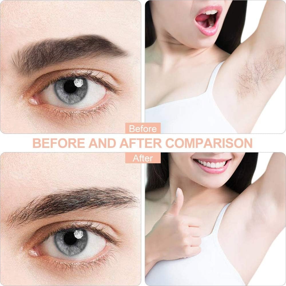 Epilator Facial 2 în 1 – Trimmer Electric pentru Sprancene si Indepartarea Fara Durere a Parului [4]